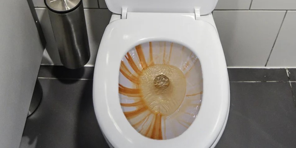 How to clean the ring around the toilet. A detailed guide.